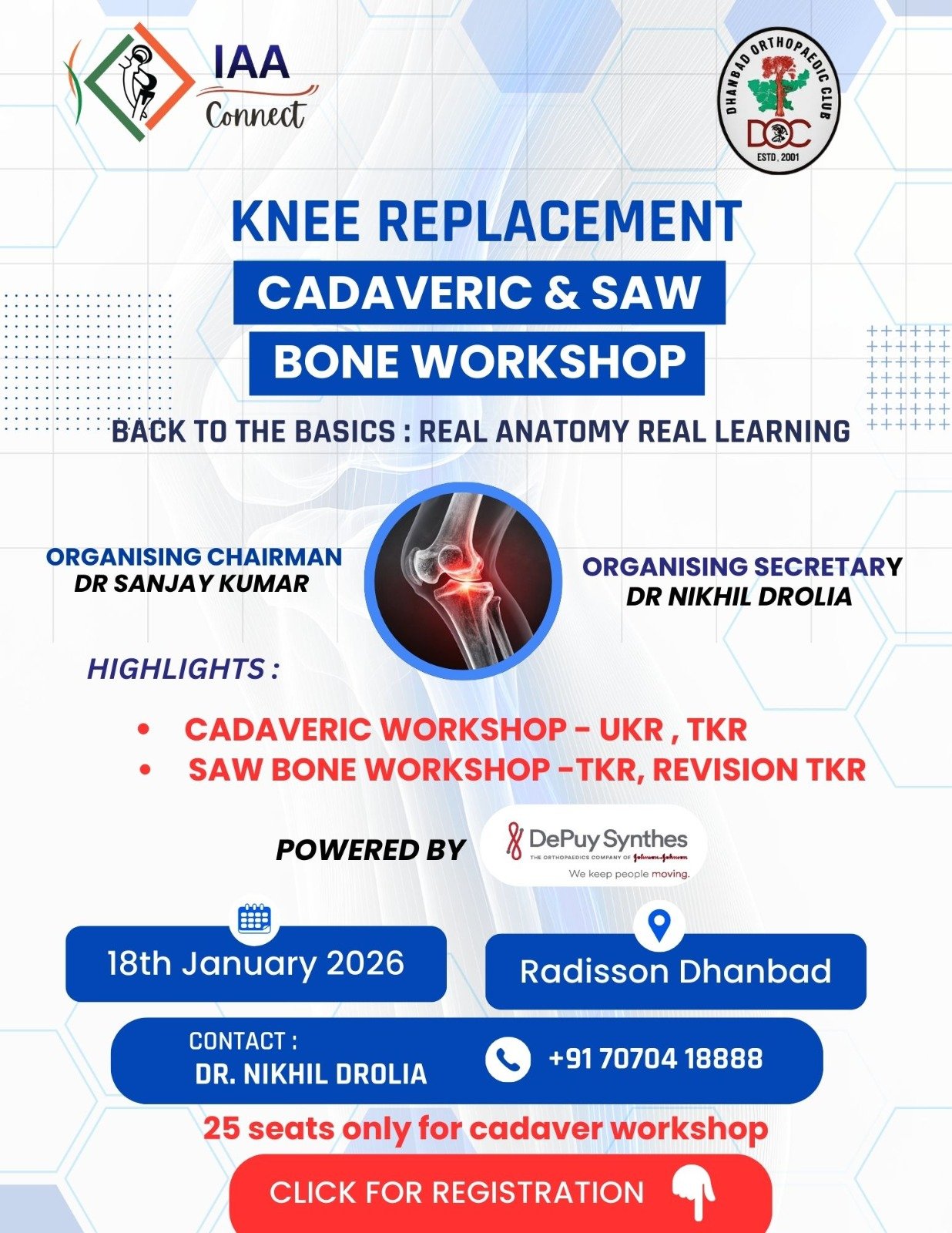 KNEE REPLACEMENT
